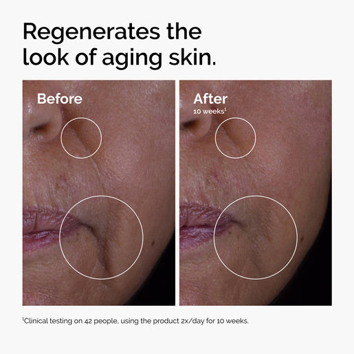 The Ordinary 30mL GF 15% facial treatment serum