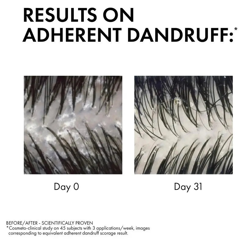 Dercos Anti-Dandruff Shampoo for Sensitive Scalp 200ml for gentle cleansing and flake-free hair
