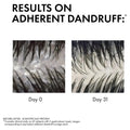 Dercos Anti-Dandruff DS Shampoo for Dry Hair 200ml for flake-free, nourished, and healthy scalp